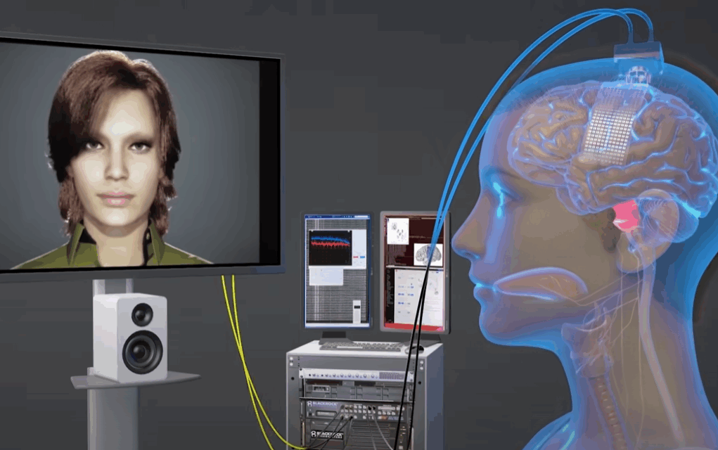 LA IA REVOLUCIONA LA NEUROPRÒTESIS DE LA PARLA: TRADUCCIÓ DE SENYALS CEREBRALS EN TEMPS REAL.
